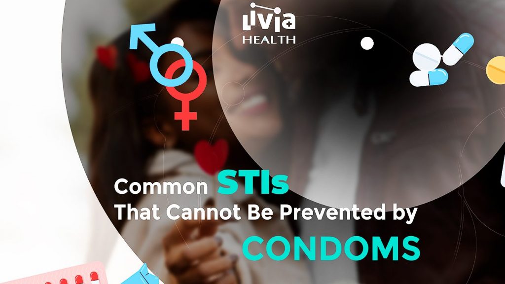 Common STIs That Cannot Be Prevented by Condoms